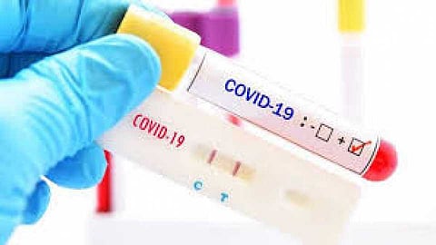 2rapid_20antigen_20test_0.jpg