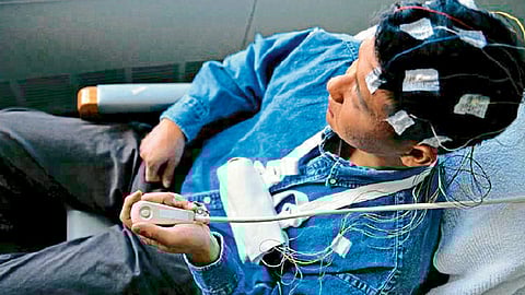 अपस्मार