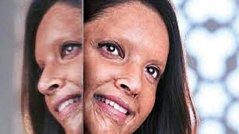 छपाक (Chhapaak) सिनेमाच्या प्रदर्शनाला स्थगिती देण्यास हायकोर्टाचा नकार.. 