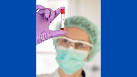 कोरोना पॉझिटिव्ह रुग्णाचा गावभर 'राउंड'; पुन्हा टेस्टसाठी आल्यावर आरोग्याधिकारी चक्रावले