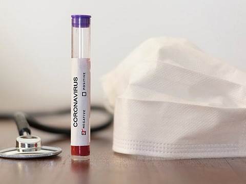 Coronavirus-test-negative.jpg