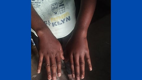 Extremely inhuman beating of three youths at Machhe belgaum police crime marathi news