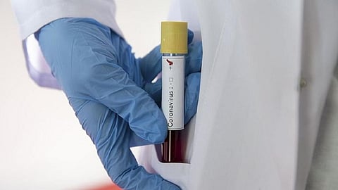 अरे देवा! कोरोना रुग्णांच्या हाती थोपलं तब्बल 18 लाखांचं बिल; वाचा बातमी सविस्तर