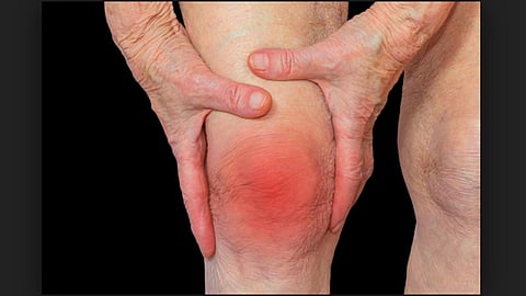 सांधेदुखीसाठी तपासण्या