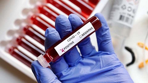 पिंपरी-चिंचवड : दुपारी १५७ असलेला रुग्णांचा आकडा सायंकाळी एवढा वाढला...