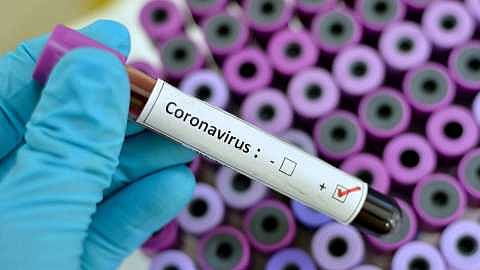 In Solapur Corona on Monday claimed seven death an increase of 25 patients and a total of 608 affected