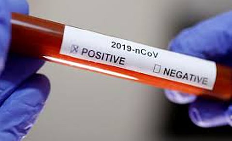 Forty thousand people in Nagpur district recovered from corona disease