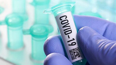 पिंपरी-चिंचवडमध्ये 432 जणांना डिस्चार्ज, तर आज सर्वाधिक पॉझिटिव्ह रुग्णांची नोंद