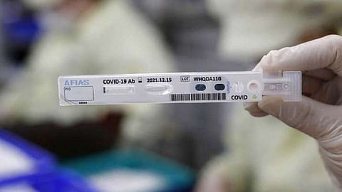 RT PCR antigen test hits 251 people in Ratnagiri in one day covid 19 update ratnagiri latest news