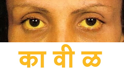 #FamilyDoctor कावीळ