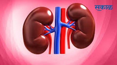 kidney