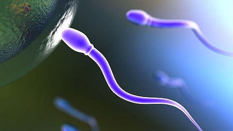 representational image