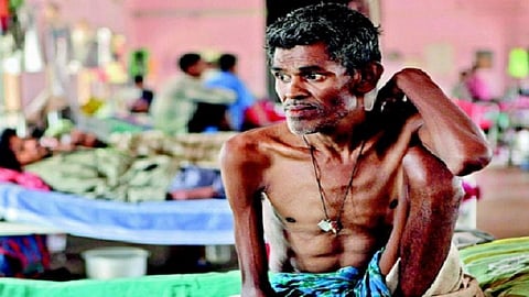 Special Reports | राज्यात नऊ हजारांवर क्षयरोगी; ठाणे, पुणे, अहमदनगरमध्ये सर्वाधिक रुग्ण 
