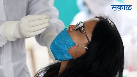Swab-Test