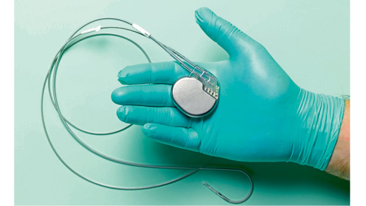 Paediatric Pacemaker Position आरोग्यमंत्र : ‘हृदयमित्र’ पेसमेकर