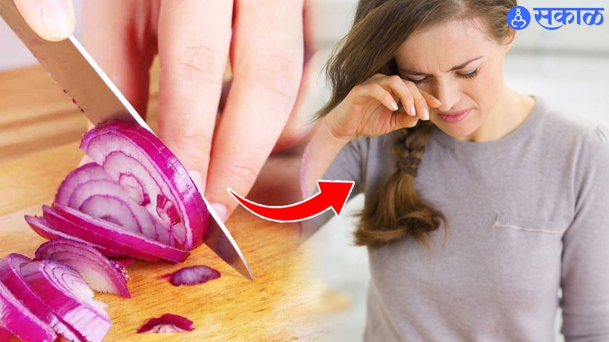 Onion Cutting Hack एवडूसा गडू पण त्याला कापताना आता नाही येणार रडू