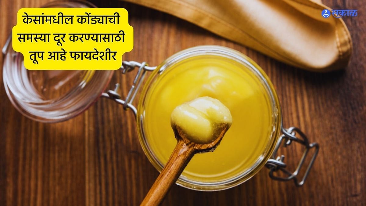 Hair Care Tips केसांमधील कोंड्याची समस्या दूर करण्यासाठी तूप आहे