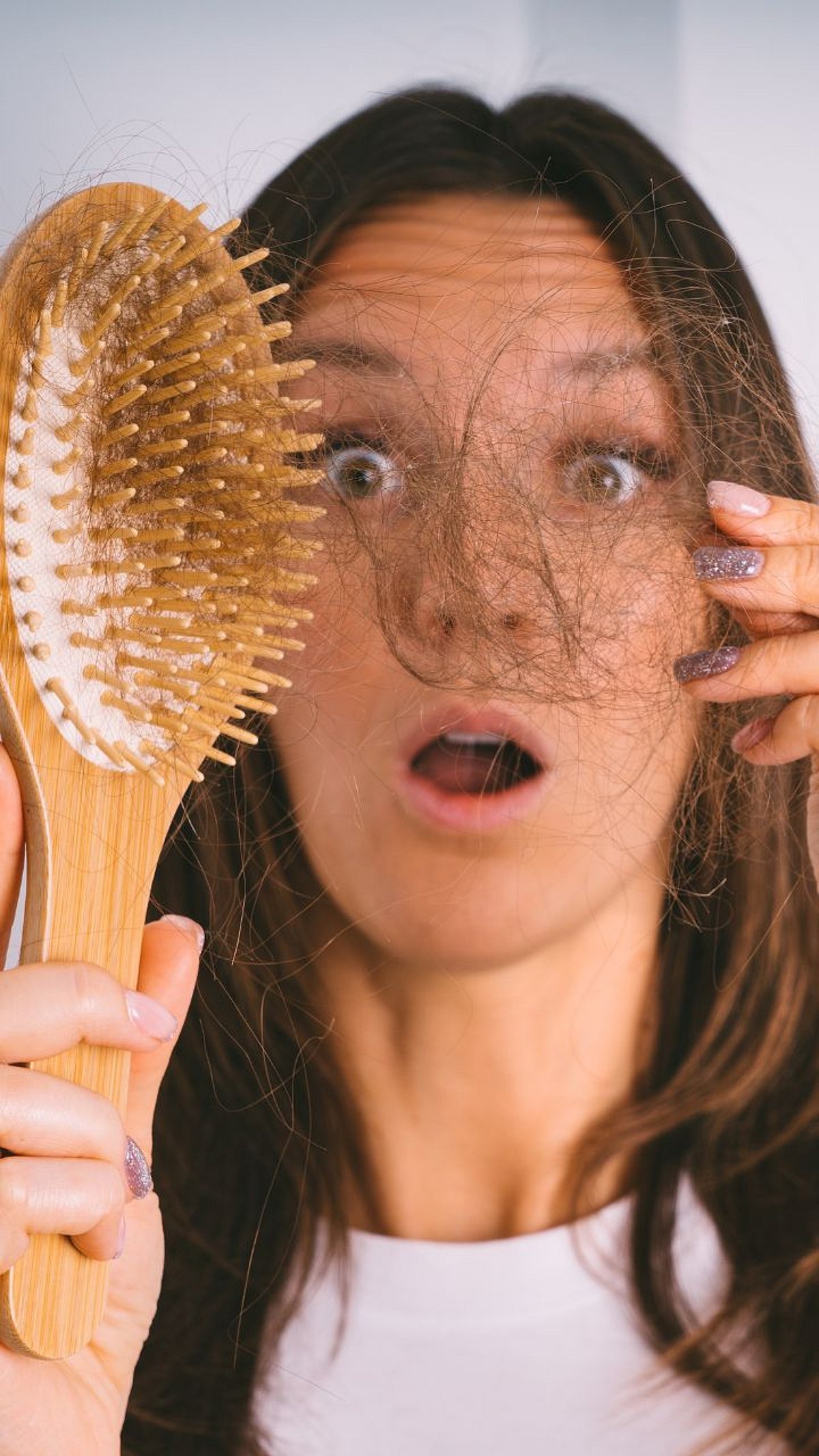 कोणत्या व्हिटॅमिनच्या कमतरतेमुळे केस गळून टक्कल पडू लागतं?