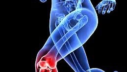 Globally Proven Medial-Pivot Knee Implant Technology Now in Bengaluru