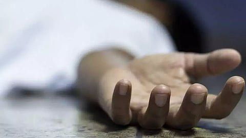 Representative Image