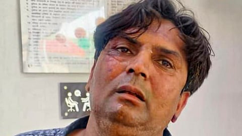 Man accused of attacking Delhi CM Gupta sent to 5 days police custody
