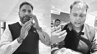 Passenger beaten by off-duty Air India Express pilot suffers nasal fracture, seeks justice