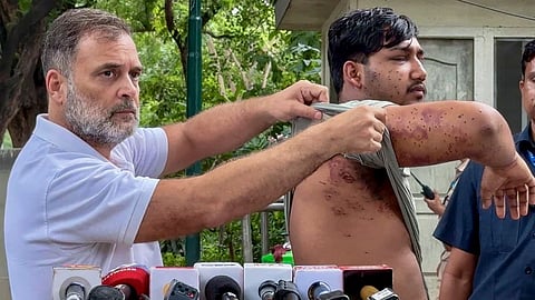 Delhi protesters allegedly hit by pellets move SC seeking ban on pellet guns in civilian protests