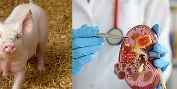 डुकराच्या शरीरात मानवीकृत किडनीची वाढ; अवयव प्रत्यारोपणाच्या दृष्टीने संशोधनास मोठे यश