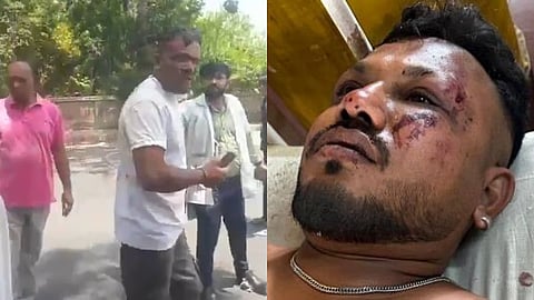 विमान अपघातातून वाचला, पण भीतीने आयुष्यच हिरावलं; विश्वास कुमारचे मानसोपचारतज्ज्ञांकडे उपचार सुरू