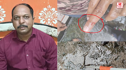 सर्पदंशानंतर 'इमर्जन्सी' विभागातच जीव धोक्यात! अग्निशमन जवानाने अनुभवली सरकारी रुग्णालयाची दयनीय अवस्था!