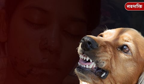 stray-dog-attack-kanpur-girl-21-year-old-injured