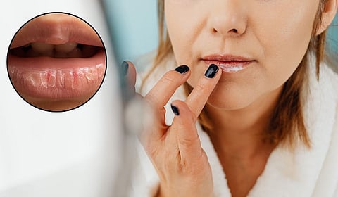 थंडीची चाहूल आणि ओठांचा कोरडेपणा; हिवाळ्यात घ्या योग्य काळजी