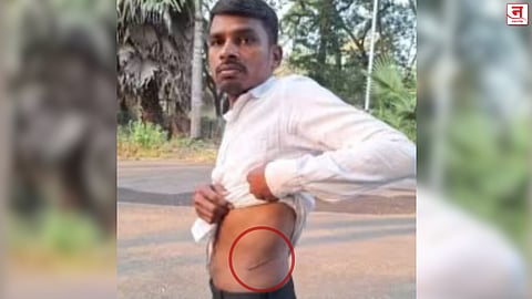 कर्ज फेड किंवा किडनी दे; कर्जबाजारी शेतकऱ्याला जाच