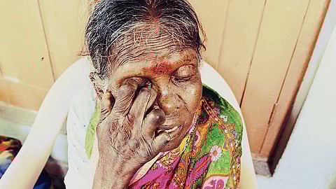 राज्याला धोका कुष्ठरोगाचा