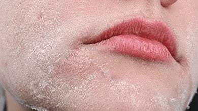 ड्राय झालेला चेहरा होईल तुकतुकीत; लावा घरातलेच ३ पदार्थ; महागड्या क्रीमची गरज नाही