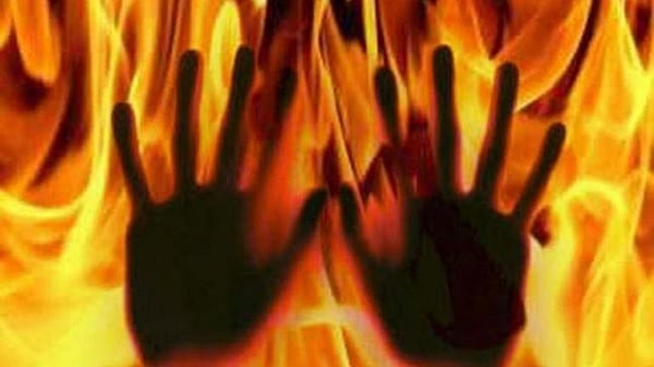 Madhya Pradesh: Four workers suffer severe burns due to hydrogen gas leakage in Nagda based chemical factory