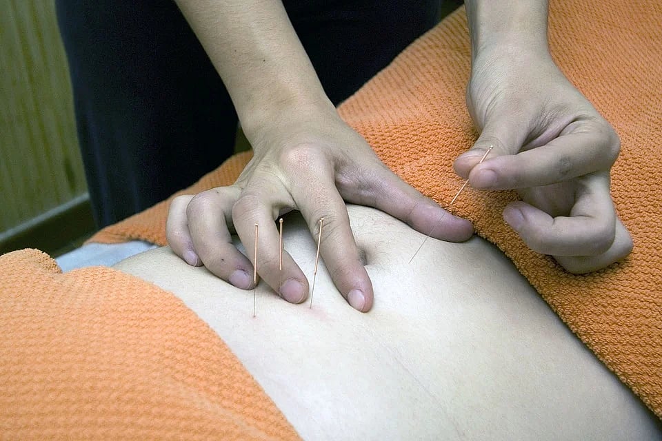 Acupuncture may be safe, effective for easing indigestion symptoms