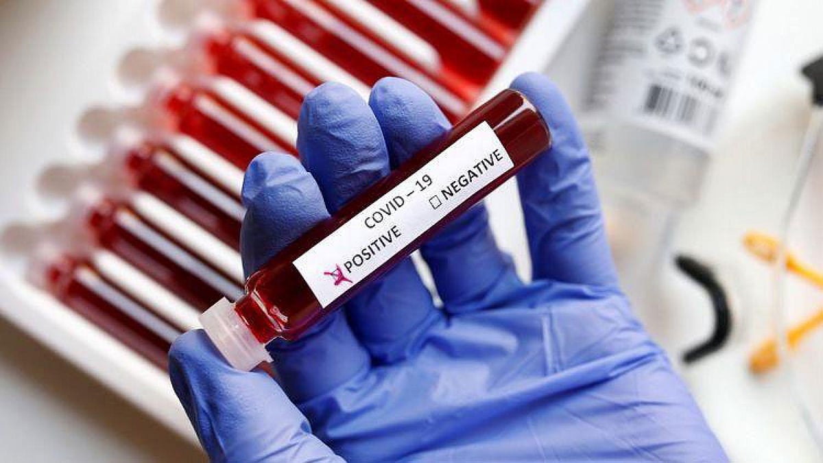 Novel portable, low-cost Covid-19 test developed