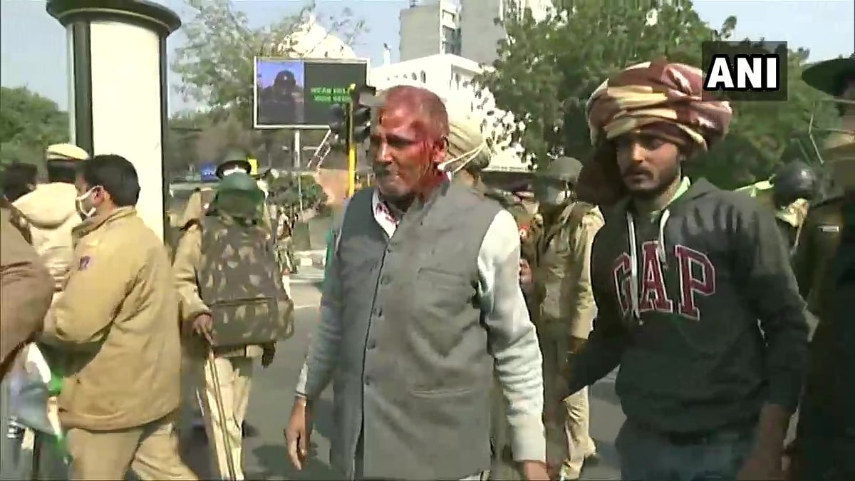 A protesting farmer injured during the clash with Police near ITO