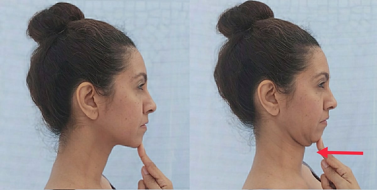 Chin Tuck Exercise: From your natural neck position tuck your chin back as 
if you are trying to give yourself a double chin. Hold this position for five seconds and then repeat 10 times. Awareness of your chin position should be corrected multiple times a day in order to correct the habit. 