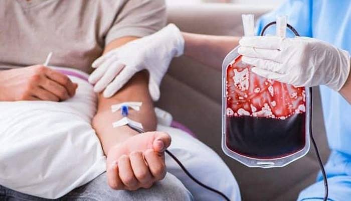 Representational image |