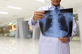 Post Covid-19 complications: Pulmonary fibrosis severity major challenge for doctors in Bhopal

