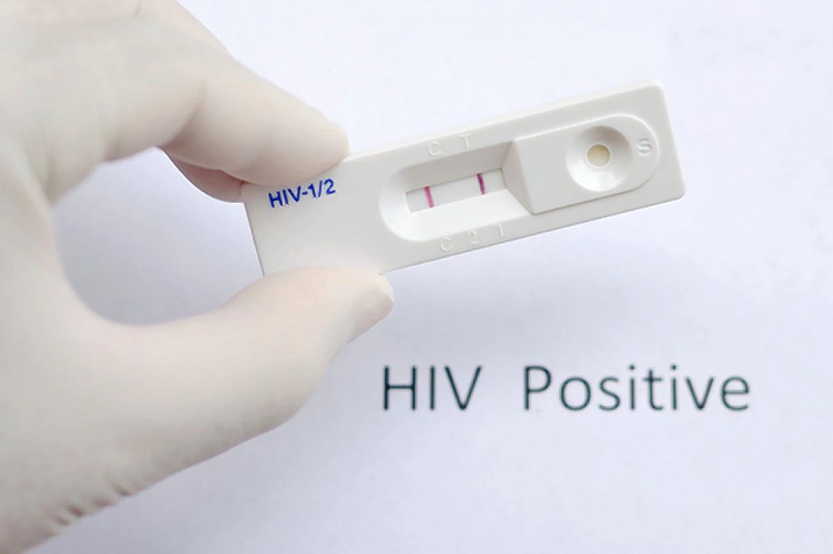 Over 85,000 people contracted HIV due to unsafe sex in India during Covid lockdown; Check state-wise numbers here 