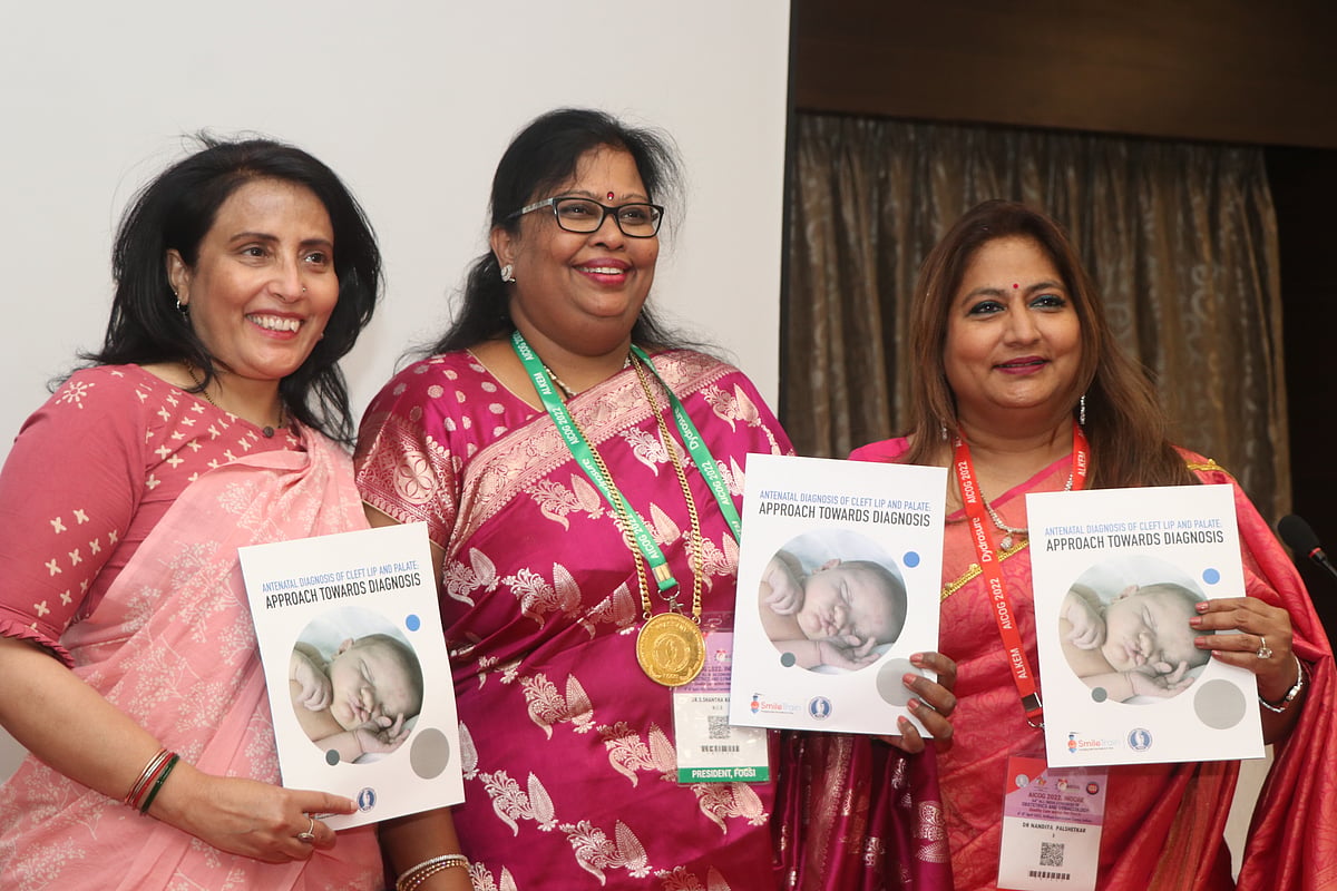 Indore: About 45,000 kids born with cleft lip and palate every year