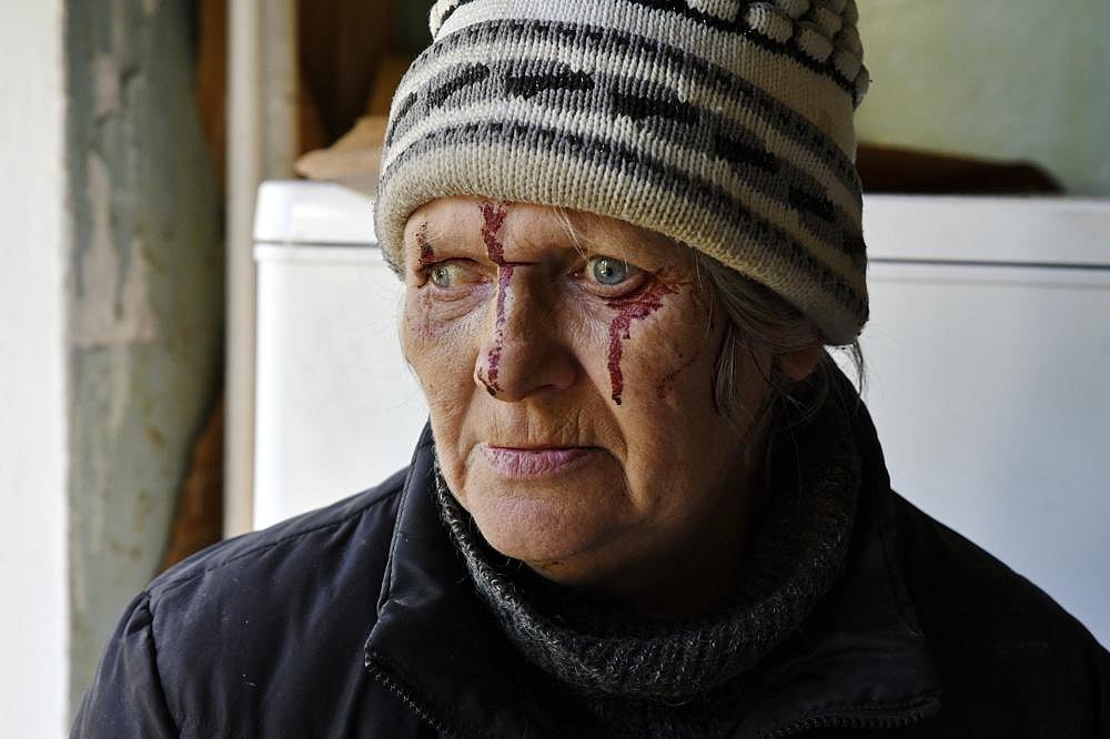 Injured Natalia Rudneva, 59, reacts as her son was hospitalised after night shelling in Kramatorsk, Ukraine, on Thursday, May 5, 2022 | AP