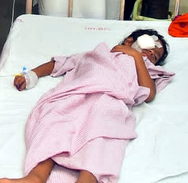Bhopal:7-year-old girl undergoes surgery after horrific dog attack; doctors assure restoration of...