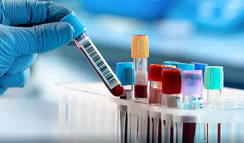 Blood tests can predict which patients are likely to die