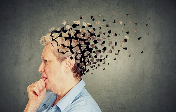 Senior citizens: Must be aware of Dementia and Alzheimer's | iStock