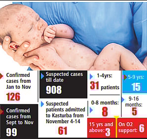 Measle cases in Mumbai thus far
