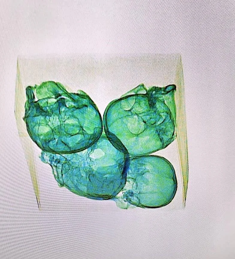 The X-ray image